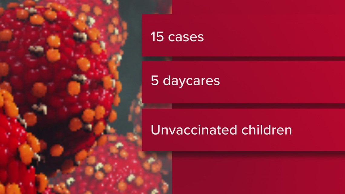 Health officials investigating 15 measles cases at 5 Columbus-area child care facilities