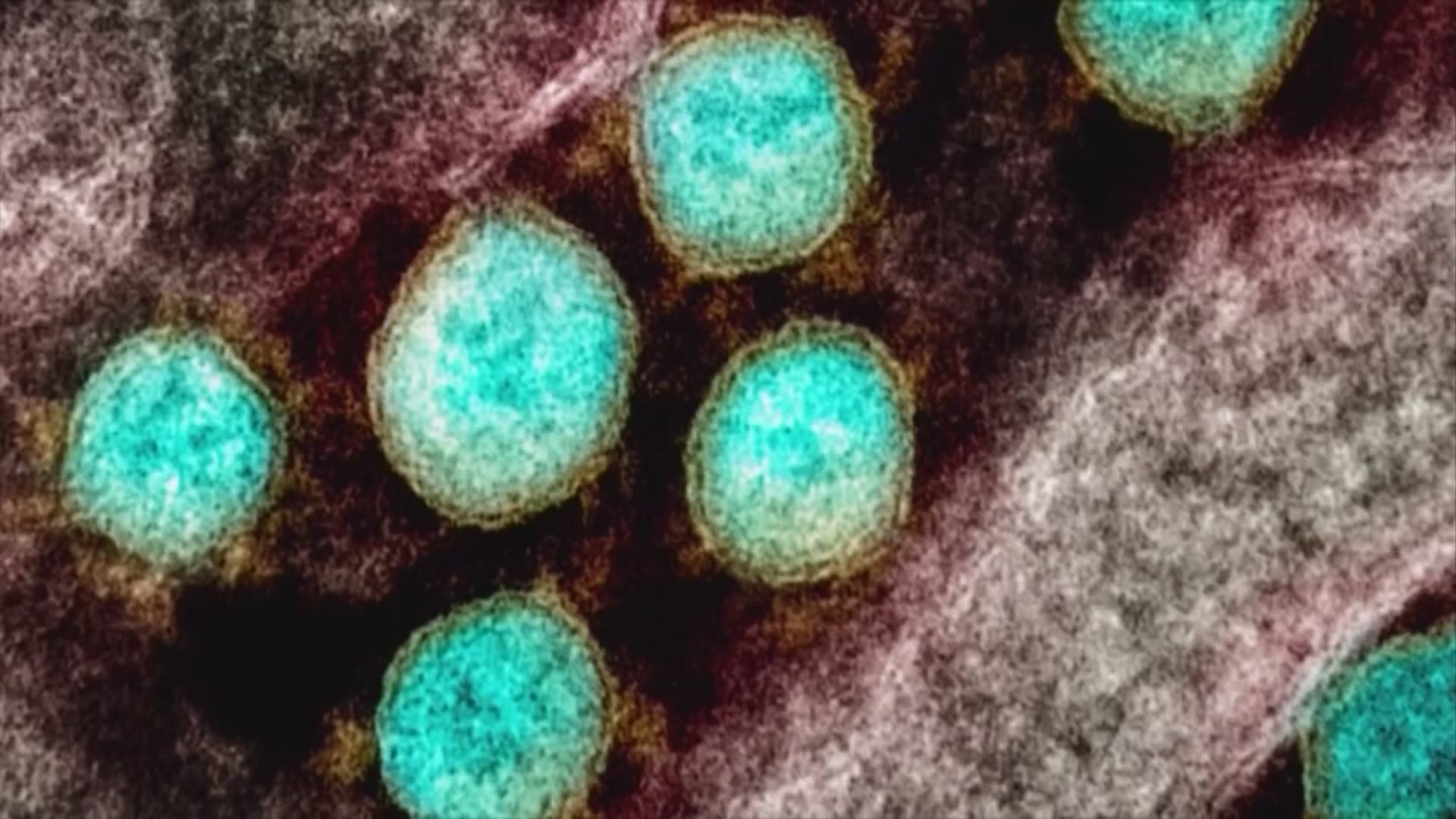 Health leaders say the delta variant is up to 60% more transmissible than the original, leaving unvaccinated people at greater risk of infection.