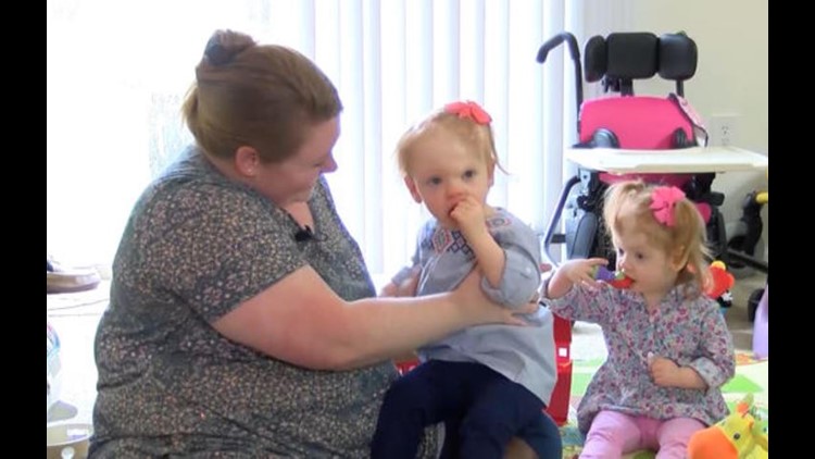 Formerly conjoined twins thriving after rare, complex surgery separated ...