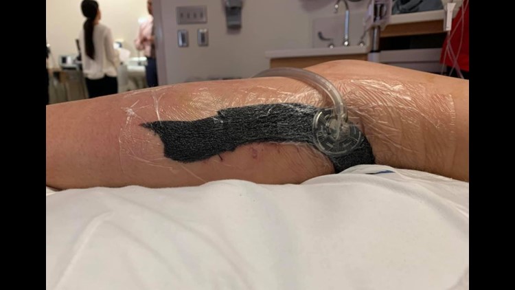 b12 injection flesh eating bacteria How Flesh-Eating Destroyed a Fitness Influencer's Life Mom warns parents after 12-year-old