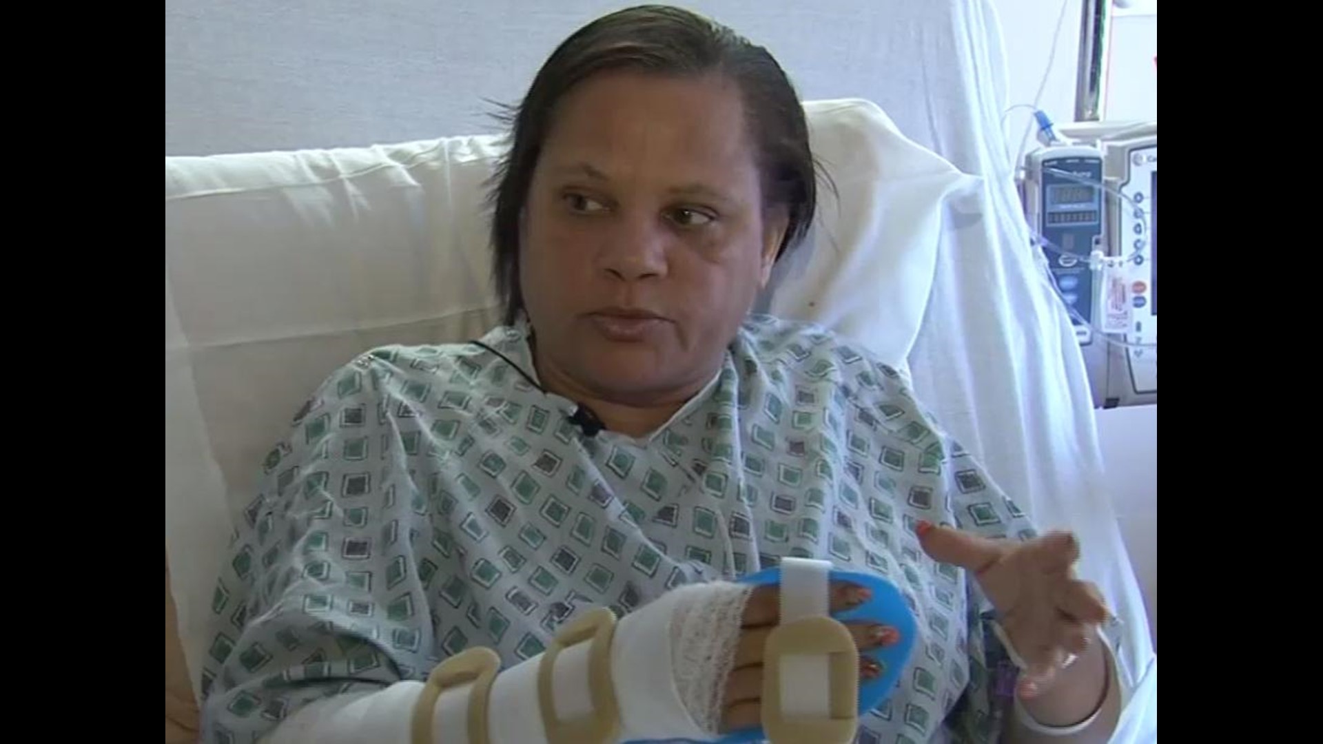 Mother’s Day Dog Attack Sends Columbus Woman To The Hospital