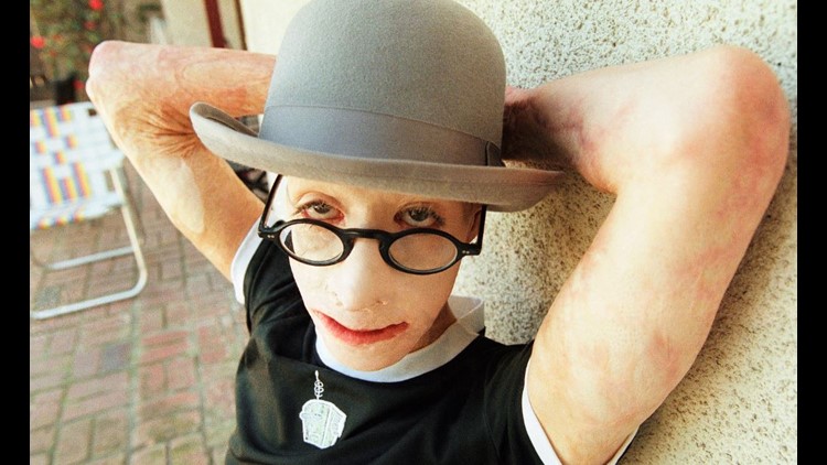 Dave Dave, who was set afire as boy, died of natural causes | 10tv.com