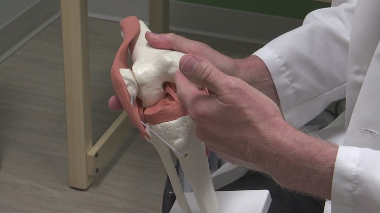 Coral-based implant offers new option for knee cartilage repair