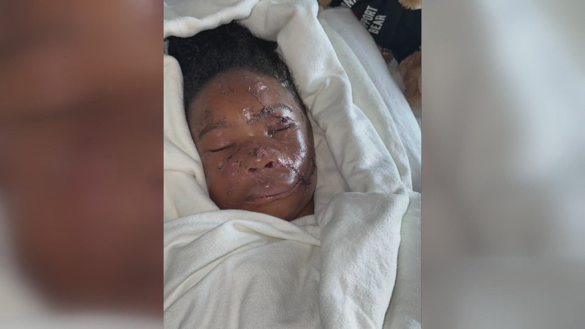 The legislation is inspired by a 12-year-old girl who was brutally attacked by two American Bully dogs last summer.