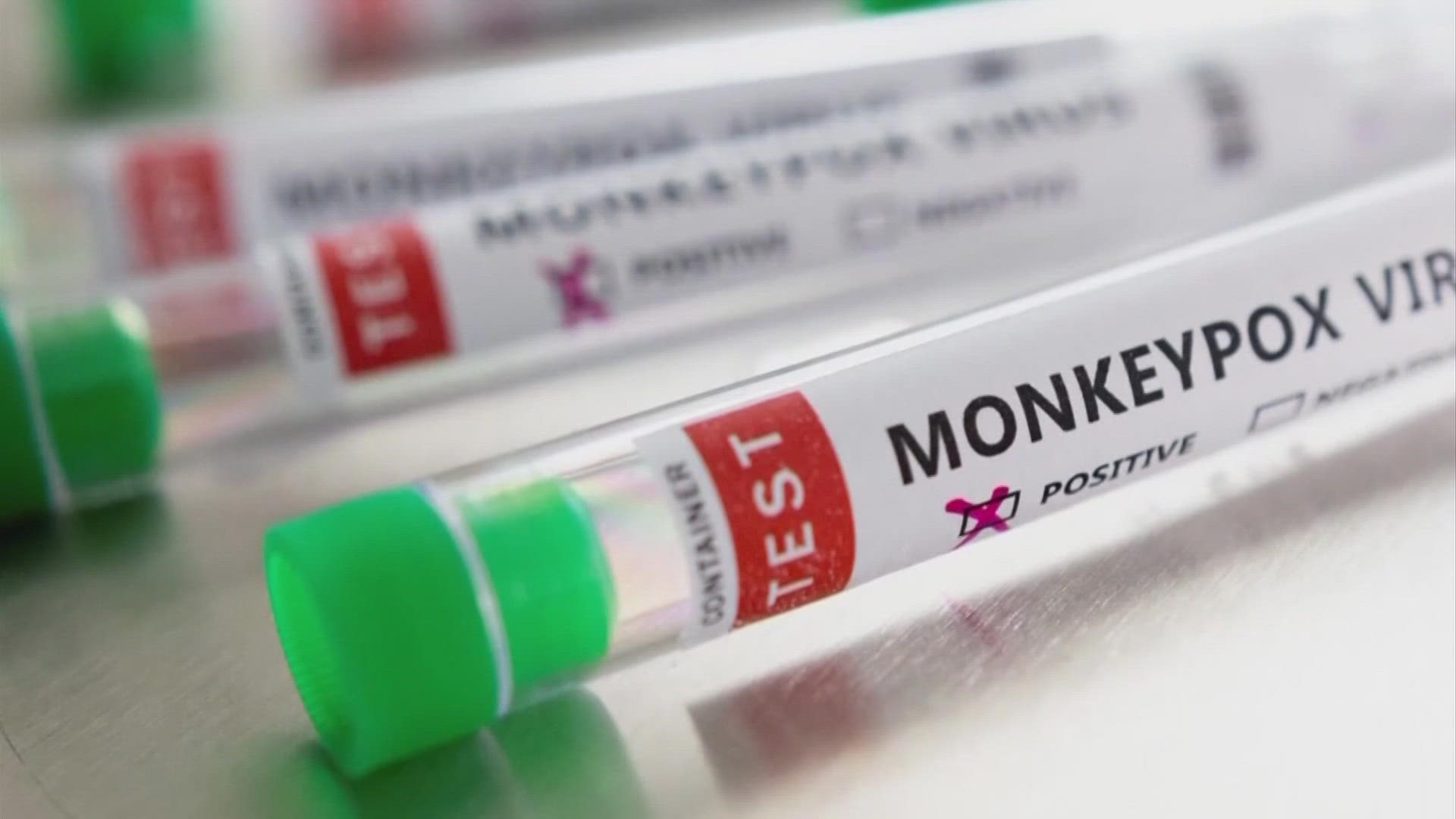 This is the second reported case of monkeypox in the state.
