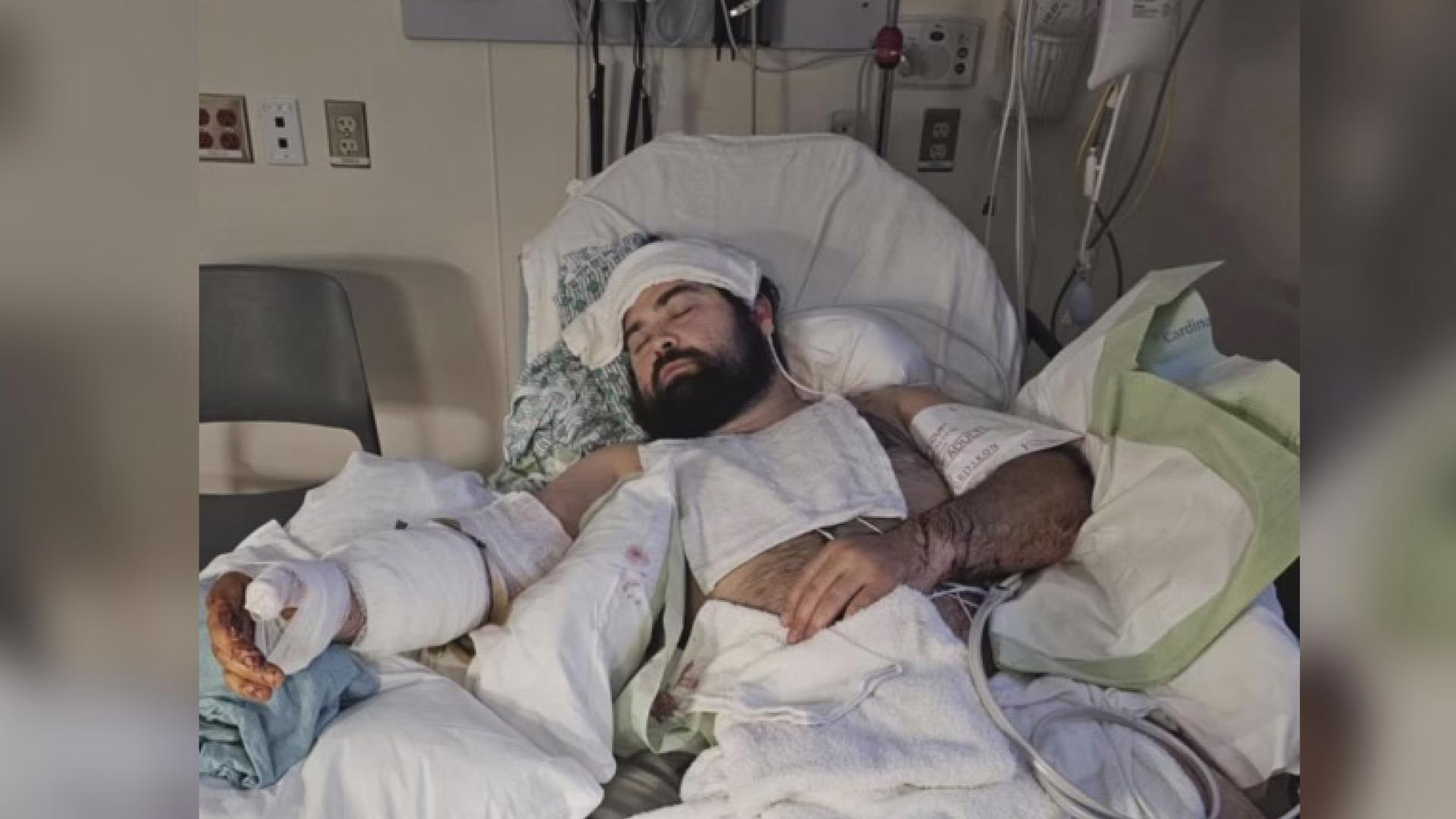 Kazimer Dec spent two and a half days in the hospital after fighting off two pit bulls on the Fourth of July. He was one of four people injured in the attacks.