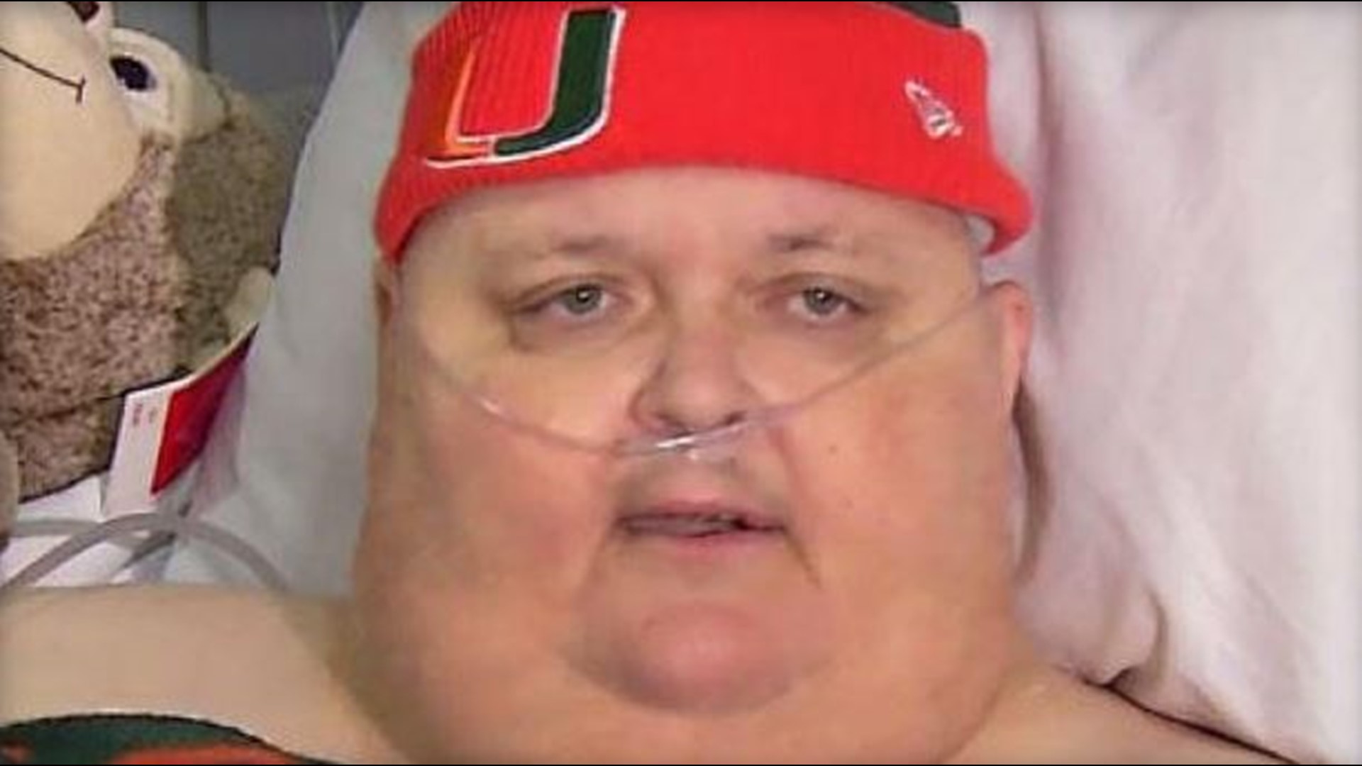 130-pound tumor removed from man who’d been told it was just fat | 10tv.com