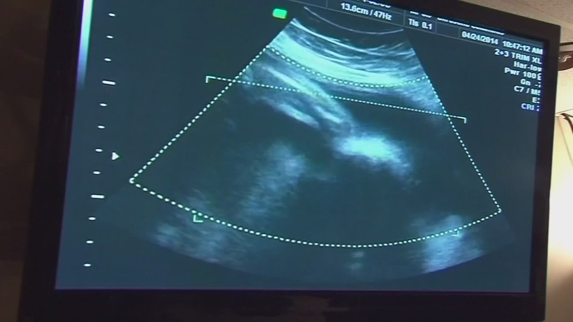 Report claims some Columbus crisis pregnancy centers provide misinformation on abortion, birth control - Vimarsana News