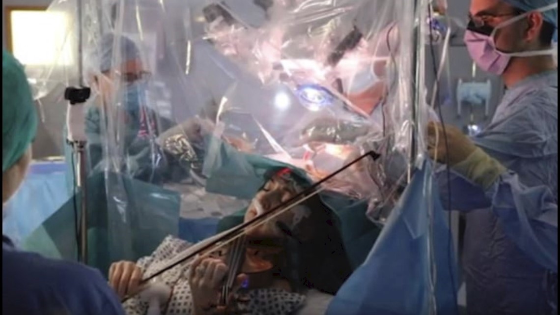 Watch this violinist play while undergoing brain surgery