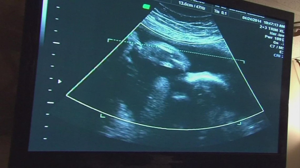 Ohio's 'Heartbeat' law now in effect after federal court lifts injunction