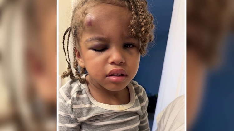 Mother demands answers after 3-year-old injured at North Carolina daycare