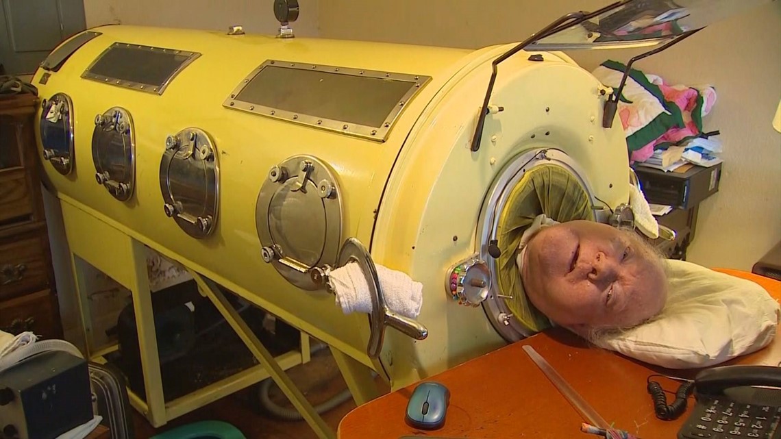 Man who lived in iron lung, Paul Alexander, dies at 78 | wnep.com