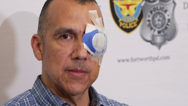 Recovering Fort Worth CRU Specialist shielded a homeowner after suffering an eye injury from gunfire