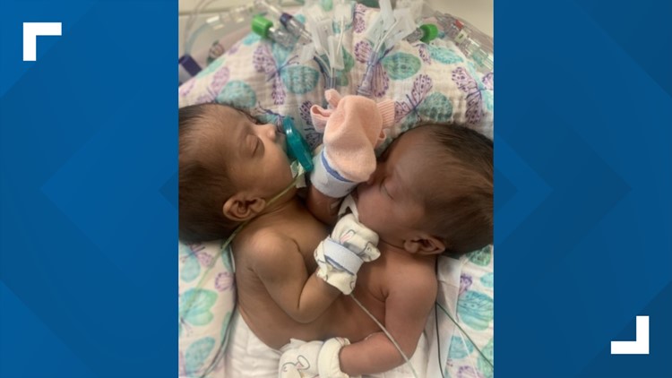 Conjoined twins separated in 11-hour historic surgery at Texas hospital