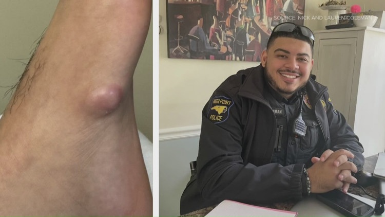 NC police officer beats rare bone cancer, returns to work after months-long fight