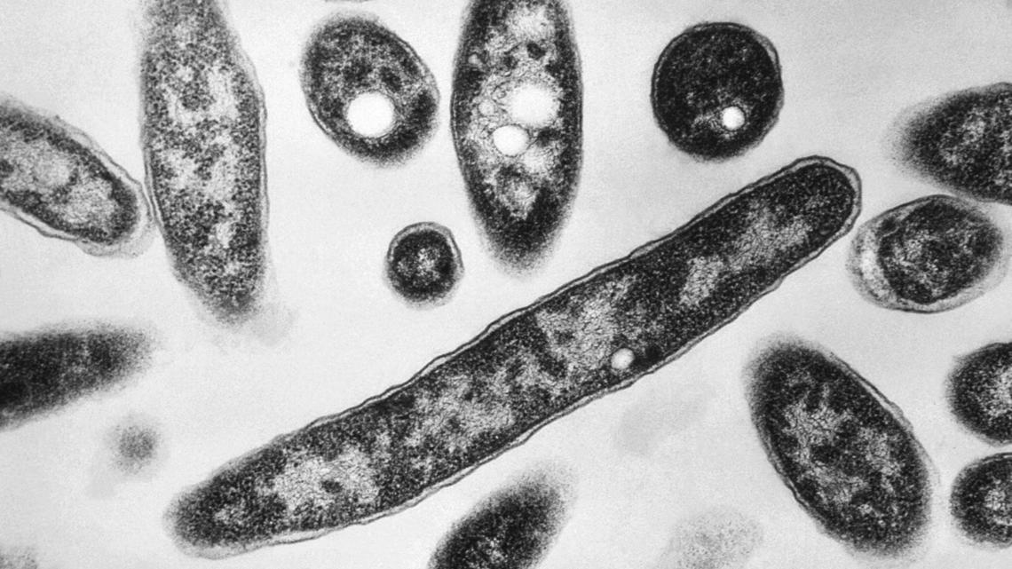 Health leaders narrow search for source in Marshall County Legionnaires’ outbreak to 12 businesses