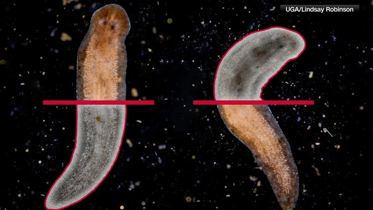 Flatworms offer brain repair clues, caregiving brain health and AI hack hits health data