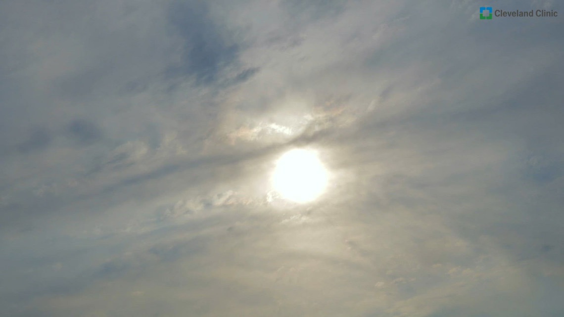 Surgeons make history, a retracted cancer study, summer hydration and why your sunglasses matter