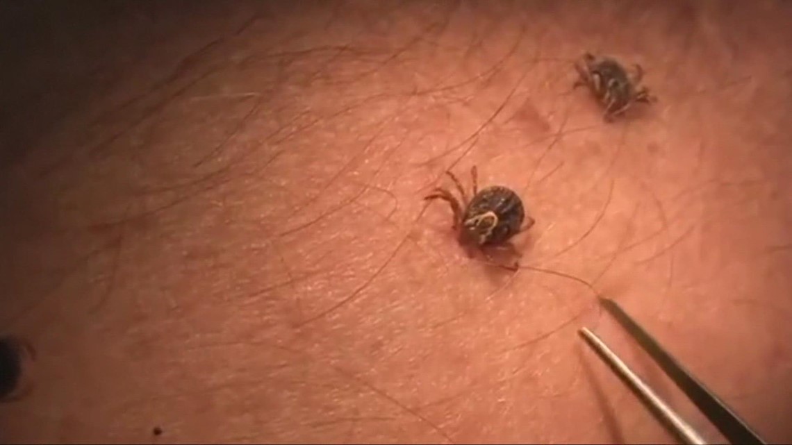 Protect your family during the tick season in the South Central