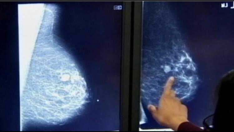 A mammogram could spot heart disease, summer's critical blood need and aging myths worth busting