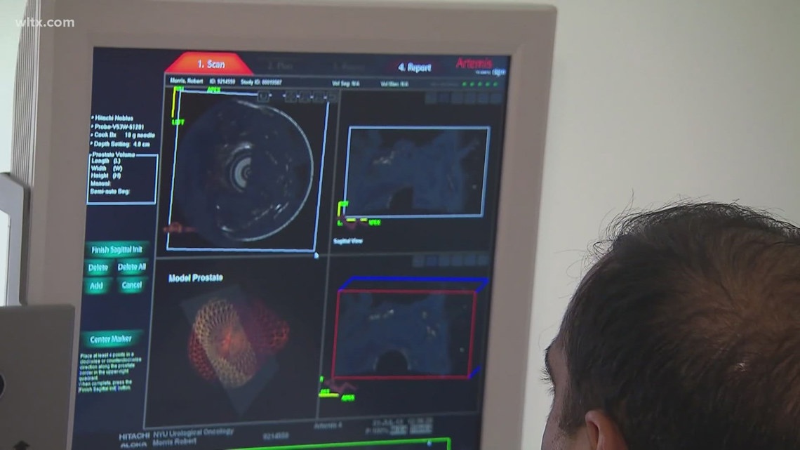 Governor Ivey signs law eliminating out-of-pocket costs for prostate cancer screenings