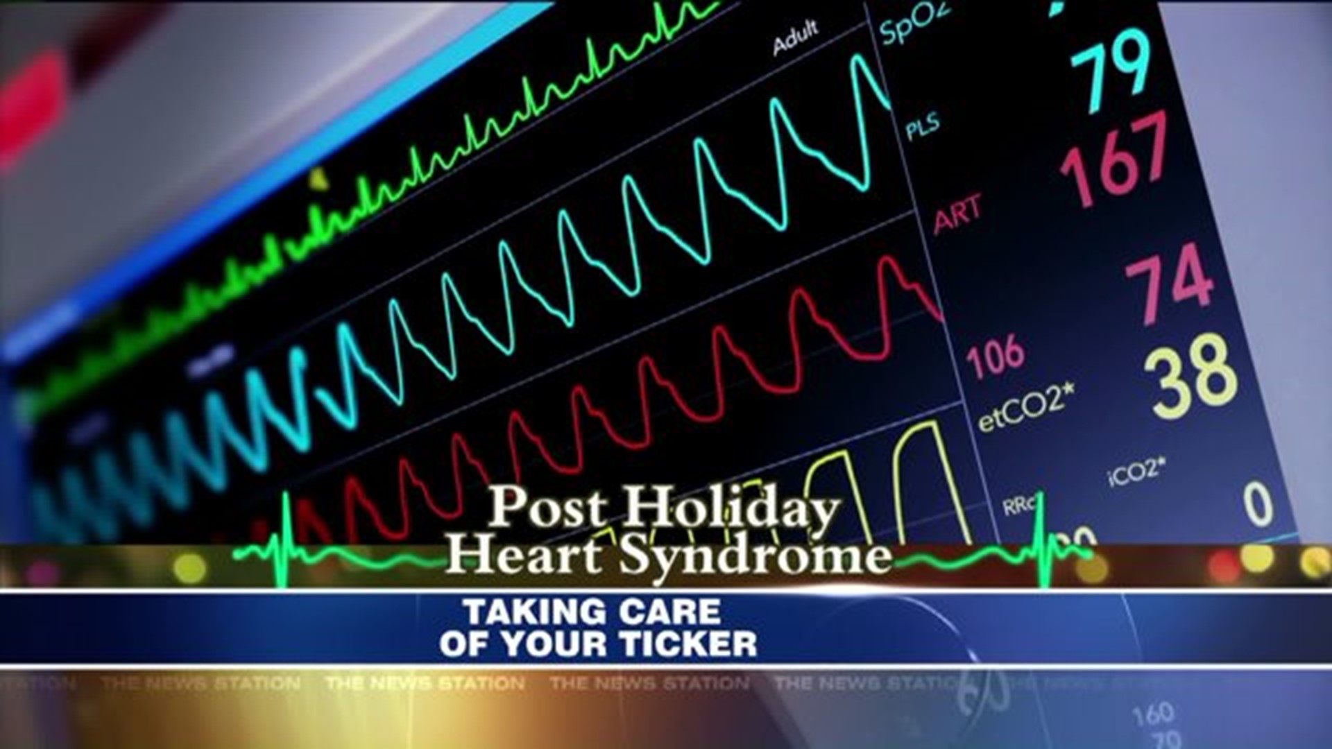 Post Holiday Heart Syndromel