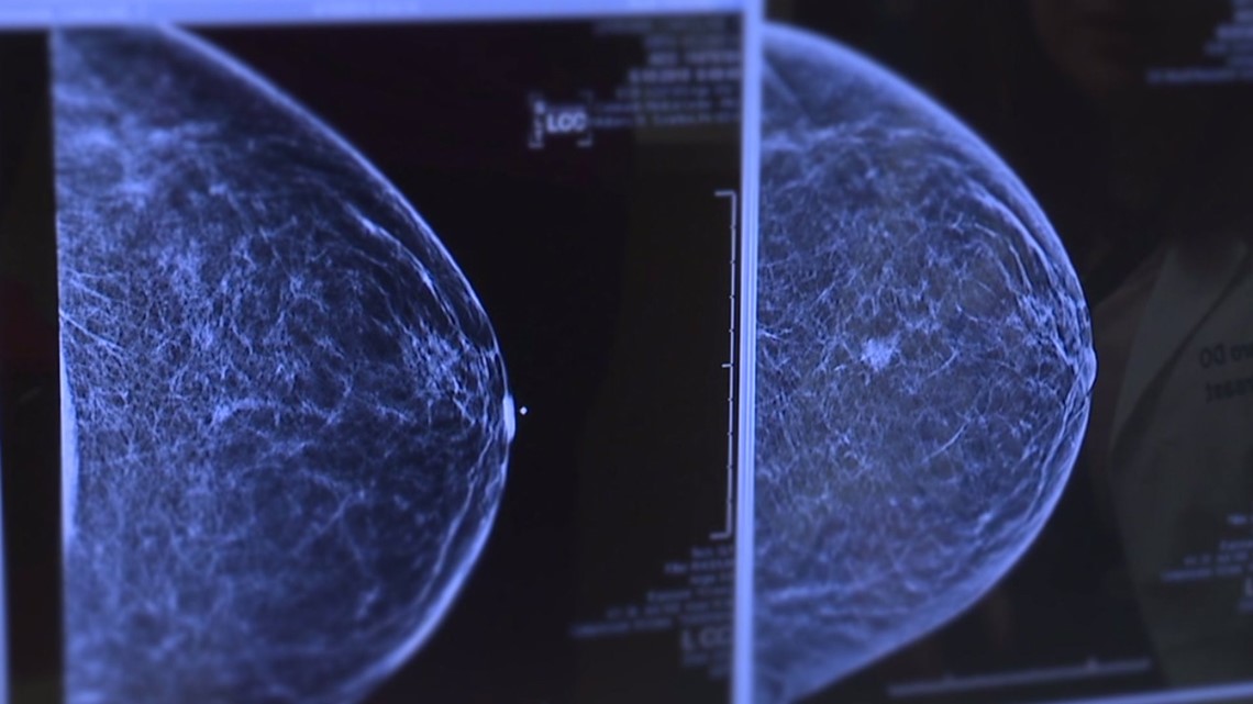 Treating Breast Cancer with 3D Imaging and Testing