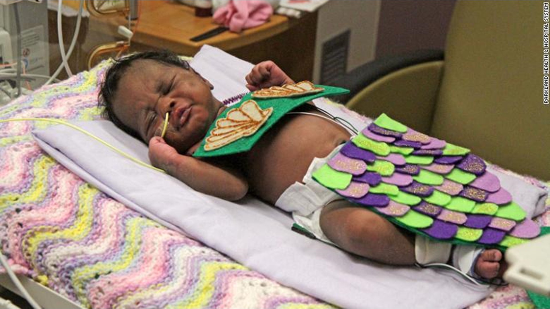 Here Are Some Adorable Photos of Babies in NICU Units Dressed Up for Halloween