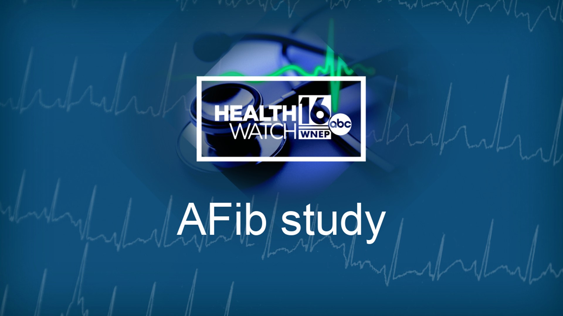 In a recently published study, Geisinger researchers found that the rates of AFib have increased significantly in past years.