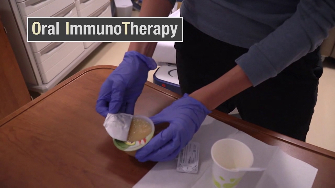 How oral immunotherapy can help food allergy sufferers | Healthwatch 16