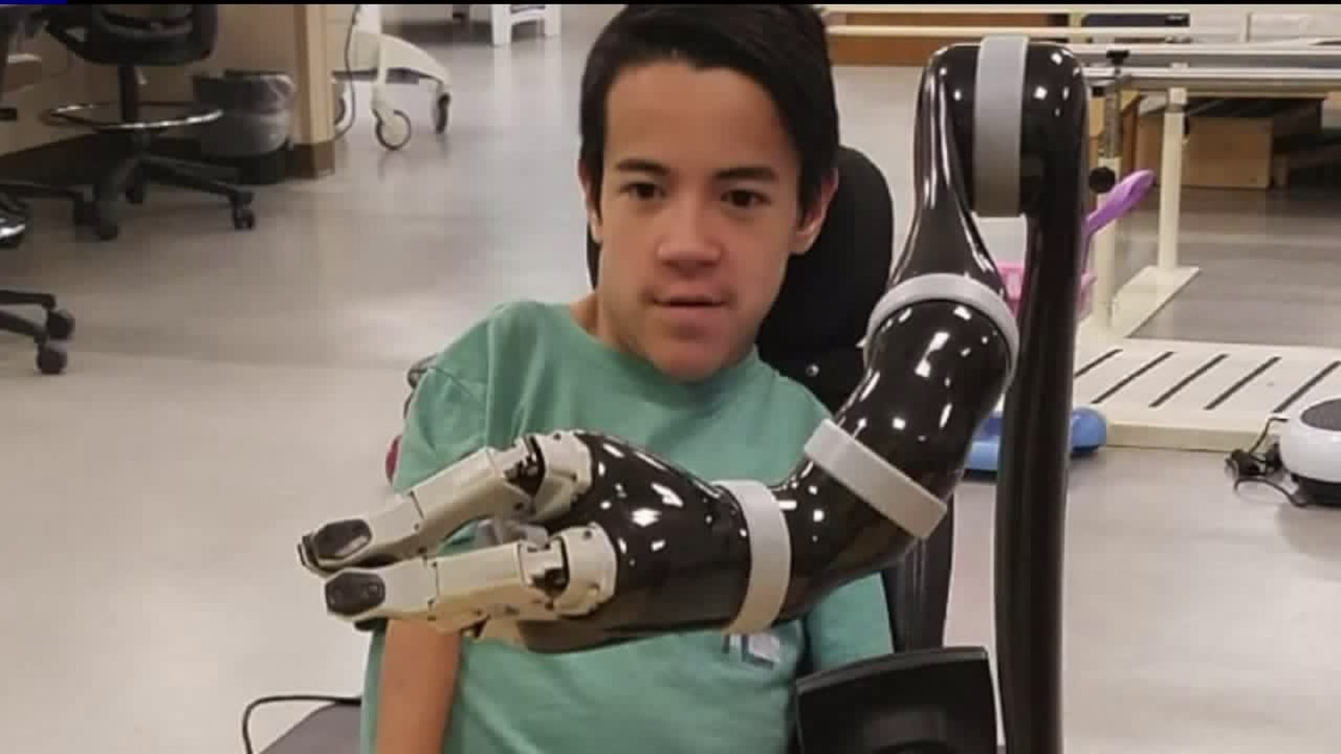 Community Raises Funds for Teen's Robotic Arm