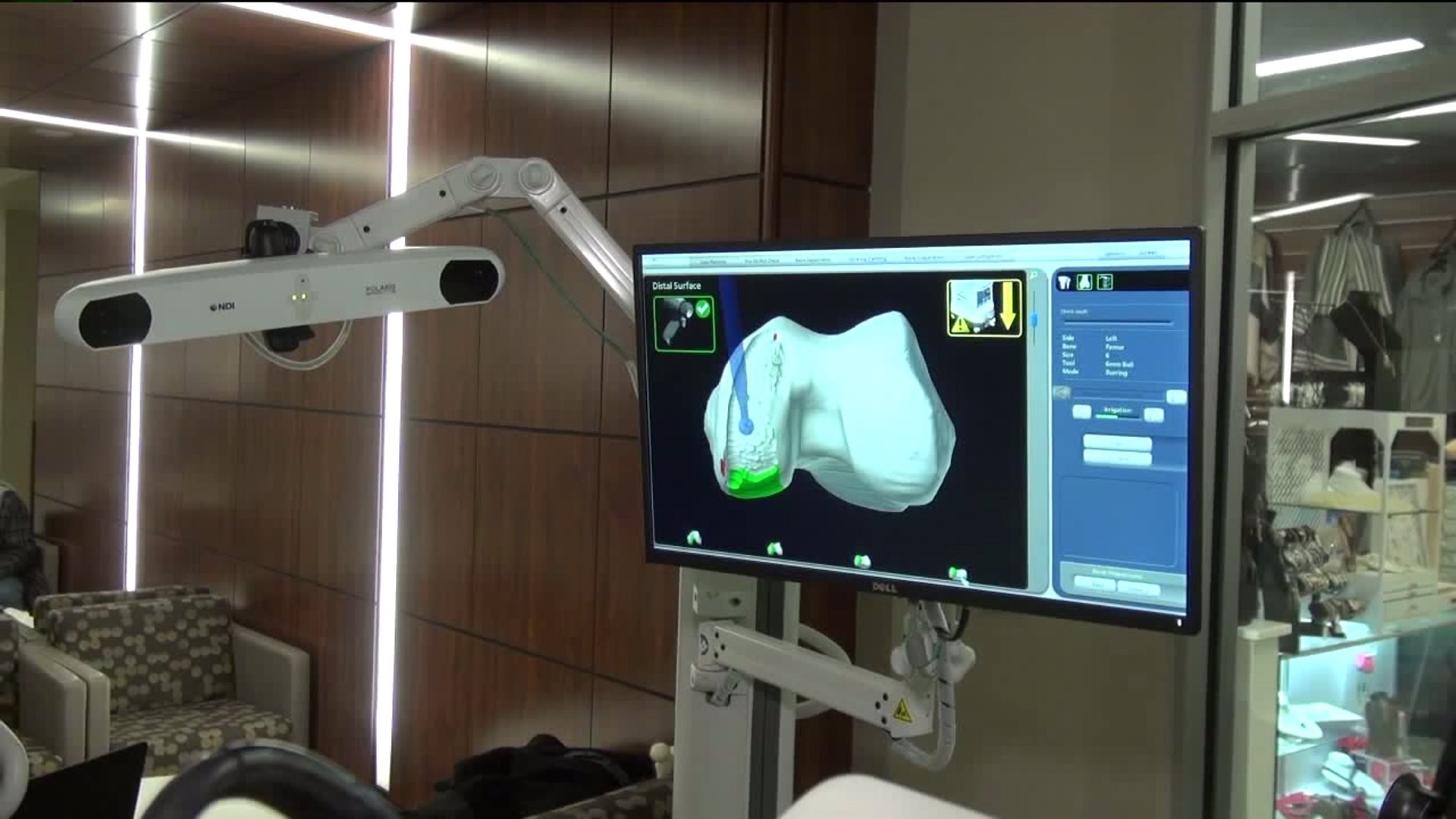 Healthwatch 16: Robotic Technology for Hip Replacement