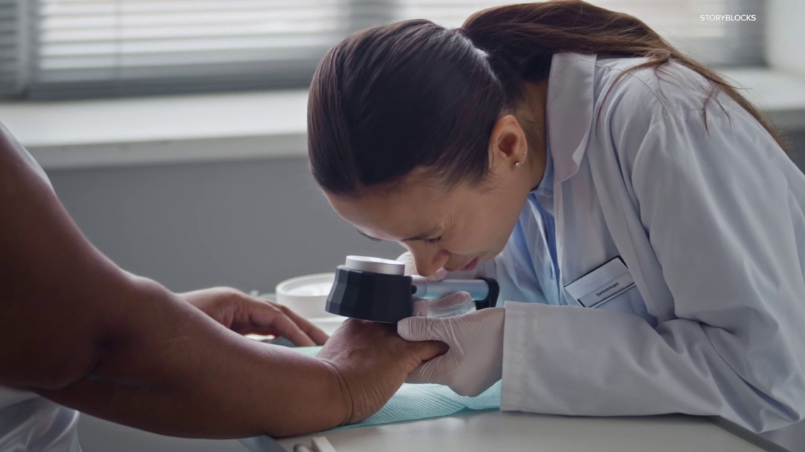 Healthwatch 16: Melanoma