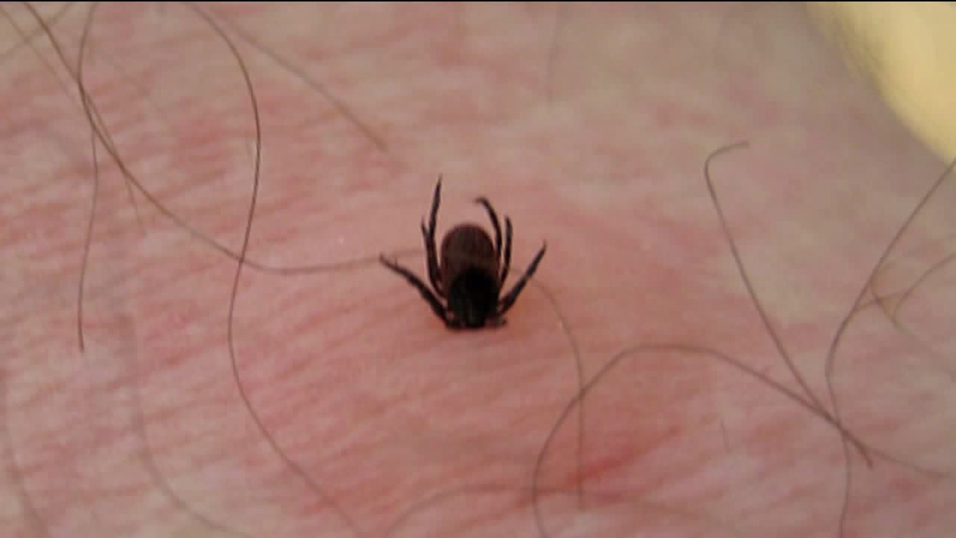 New Health Center Opening for People with Tick-Borne Diseases