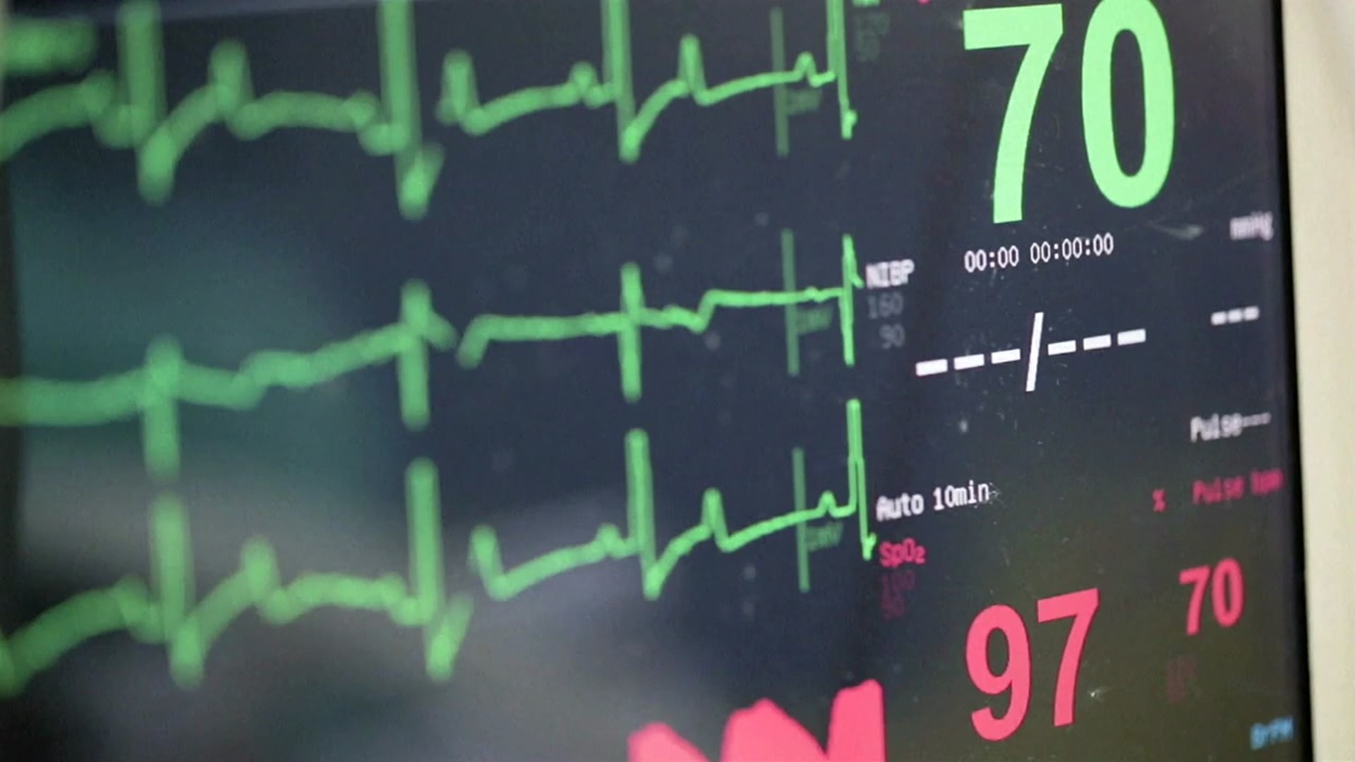 Medical professionals have seen an uptick in heart disease cases during the pandemic.