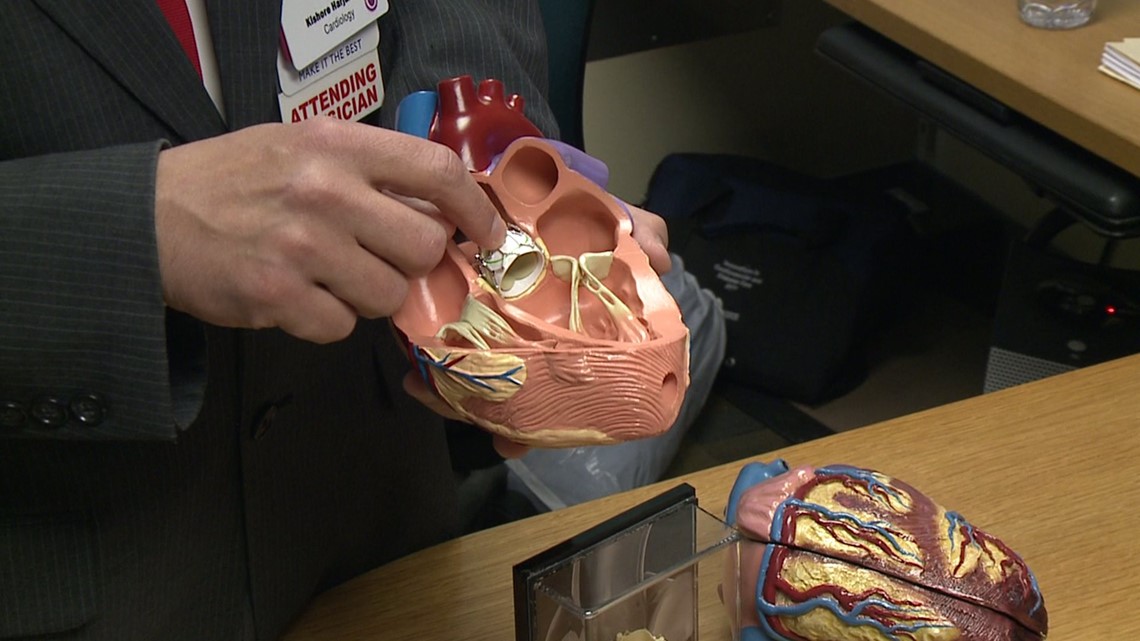 TAVR A New Heart Procedure Wnep Com