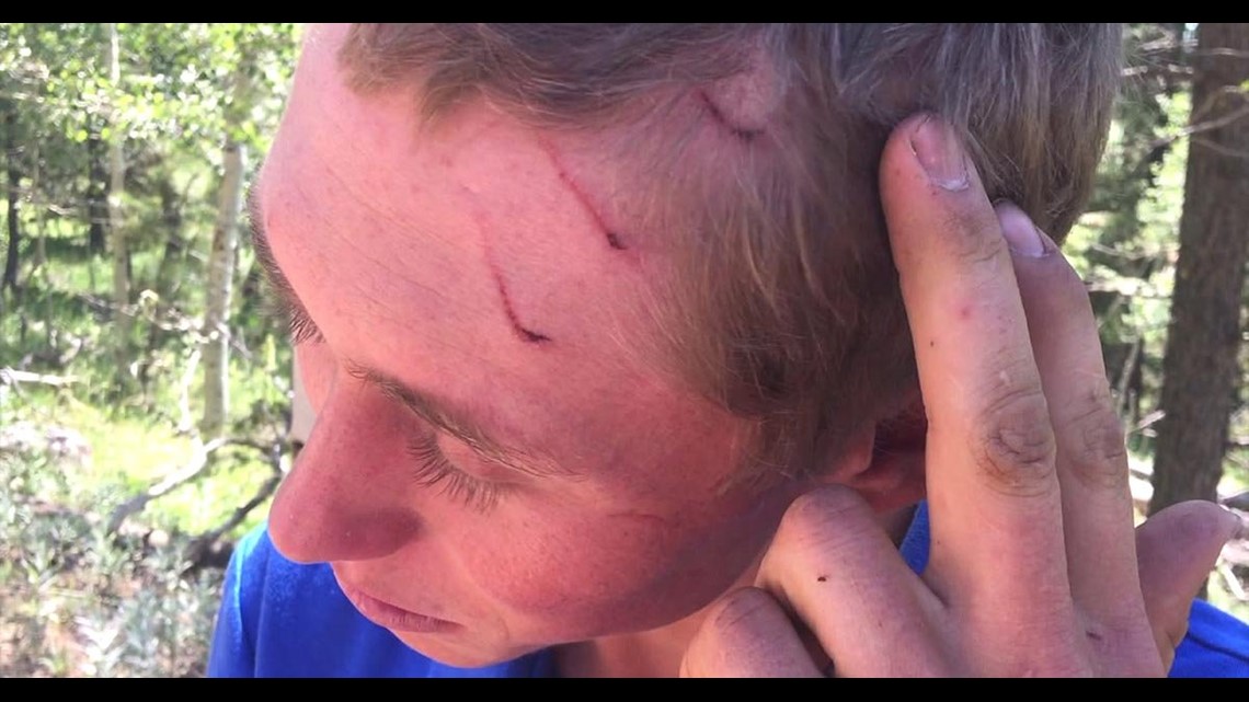 Camping Teen Awakens To Crunching Sound As Bear Bites His Head