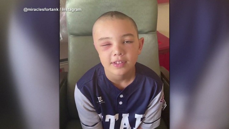 Injured Little Leaguer now recovering from home