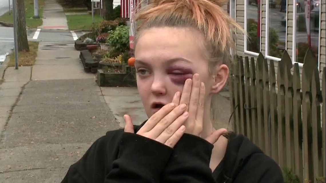 Family Plans to Press Charges after Student Punched in Face at School