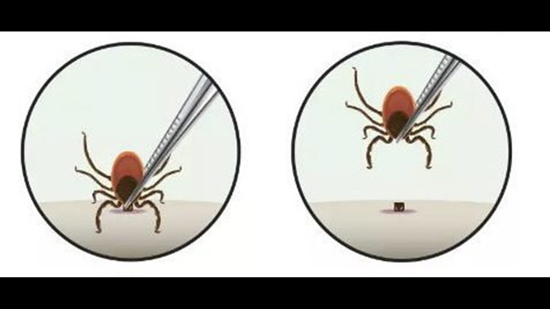 All You Need to Know About Ticks