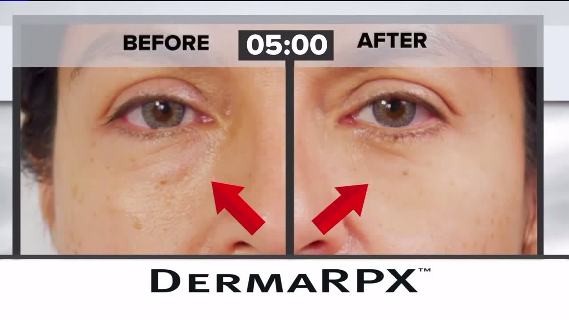 Does It Really Work: Derma RPX