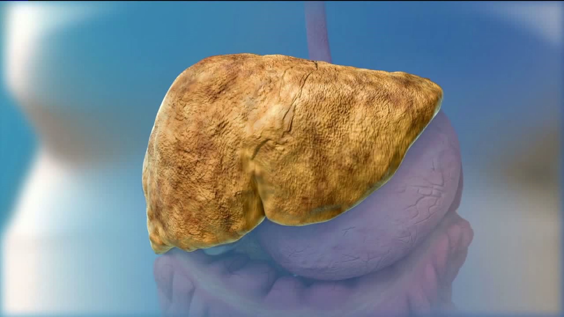 Healthwatch 16: Fatty Liver