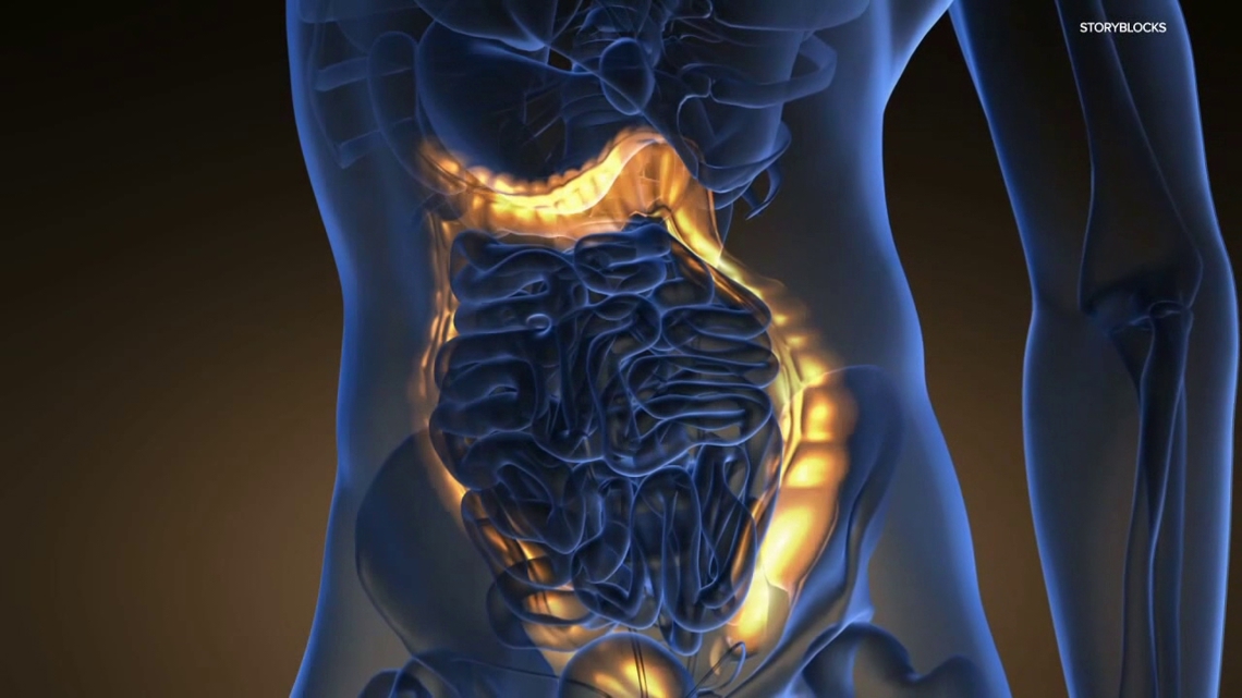 The importance of getting screened for colon cancer | Healthwatch 16