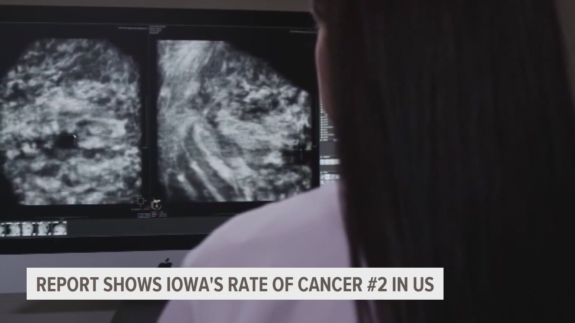 Local doctors are pointing to several risk factors that could be affecting Iowans.