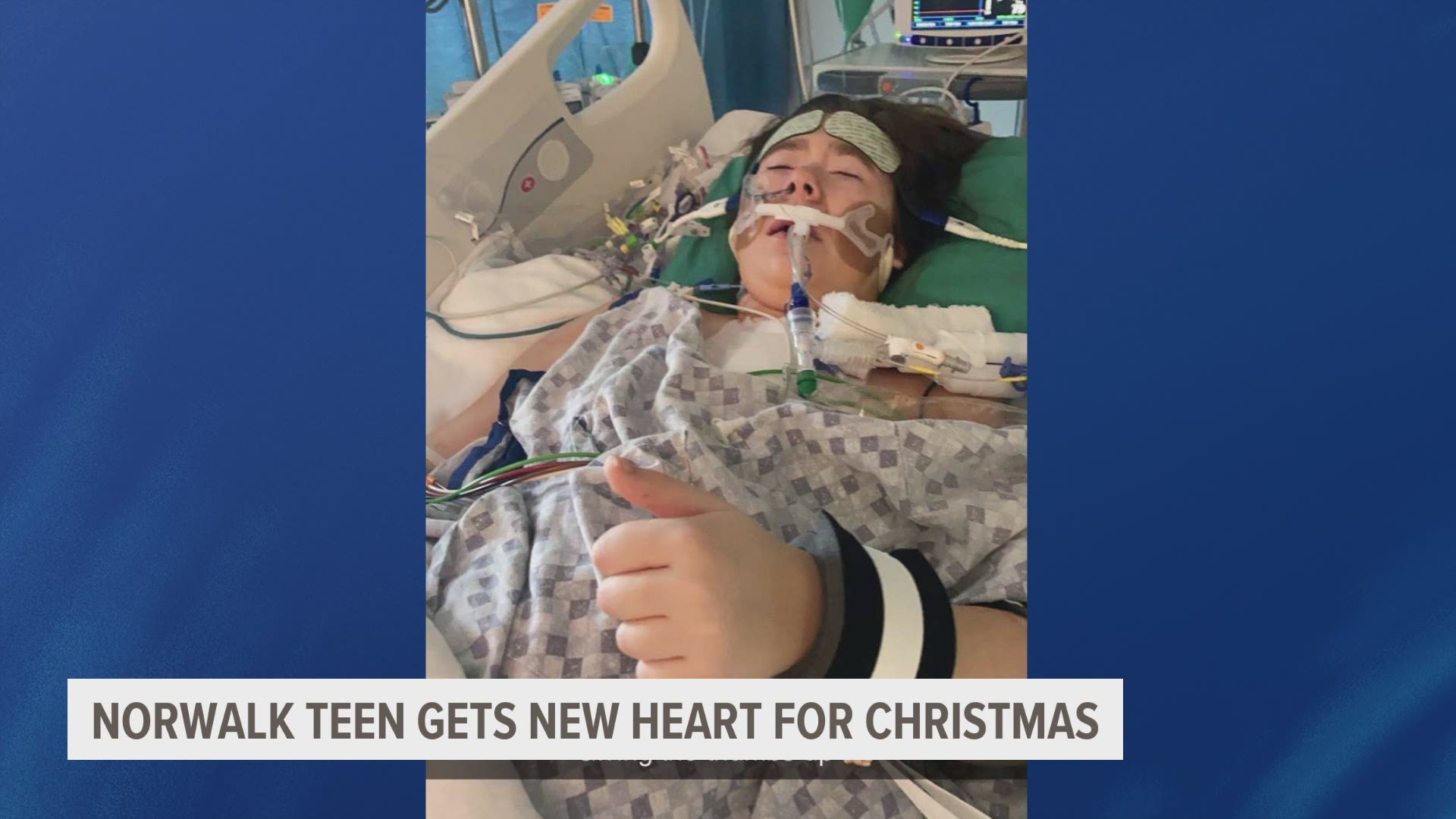 Doctors at the University of Iowa Hospitals & Clinics successfully completed a heart transplant on Brooklyn Soroka Christmas Eve.