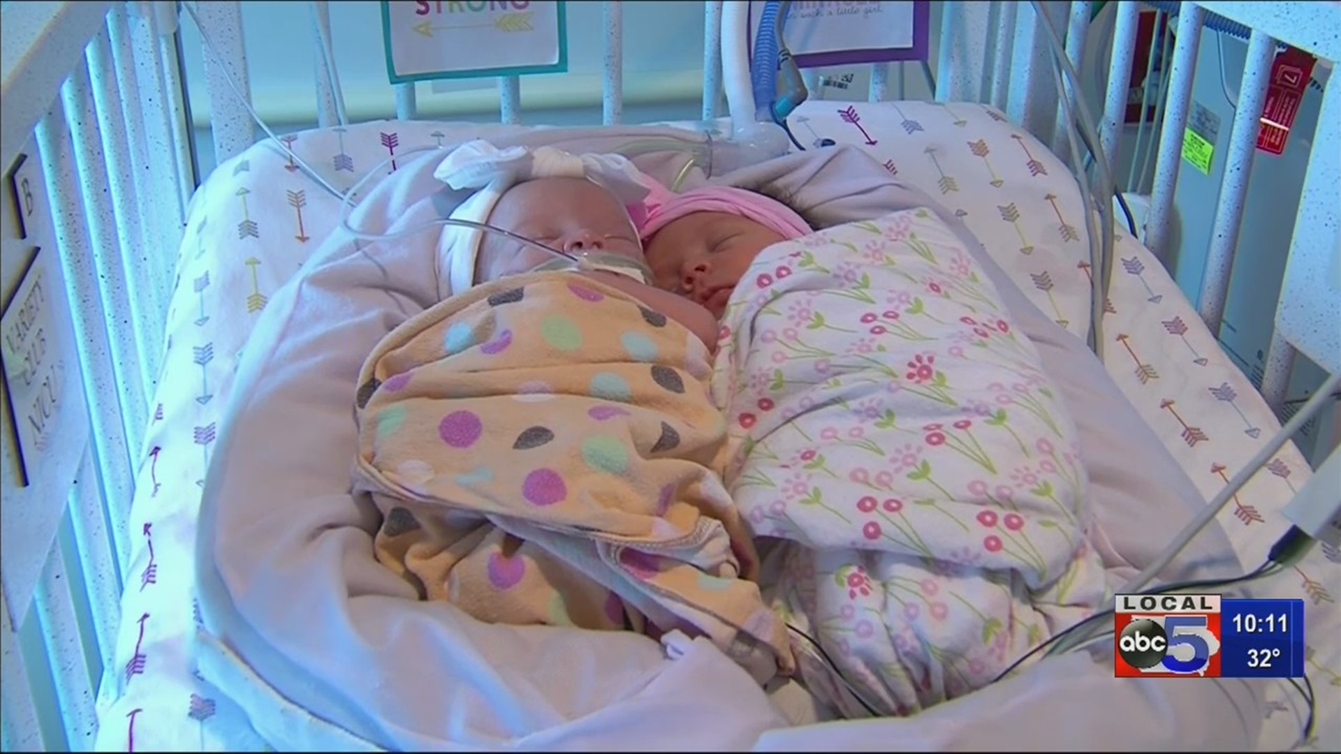 Family sacrifices everything for the safety of rare twins; watch their incredible journey