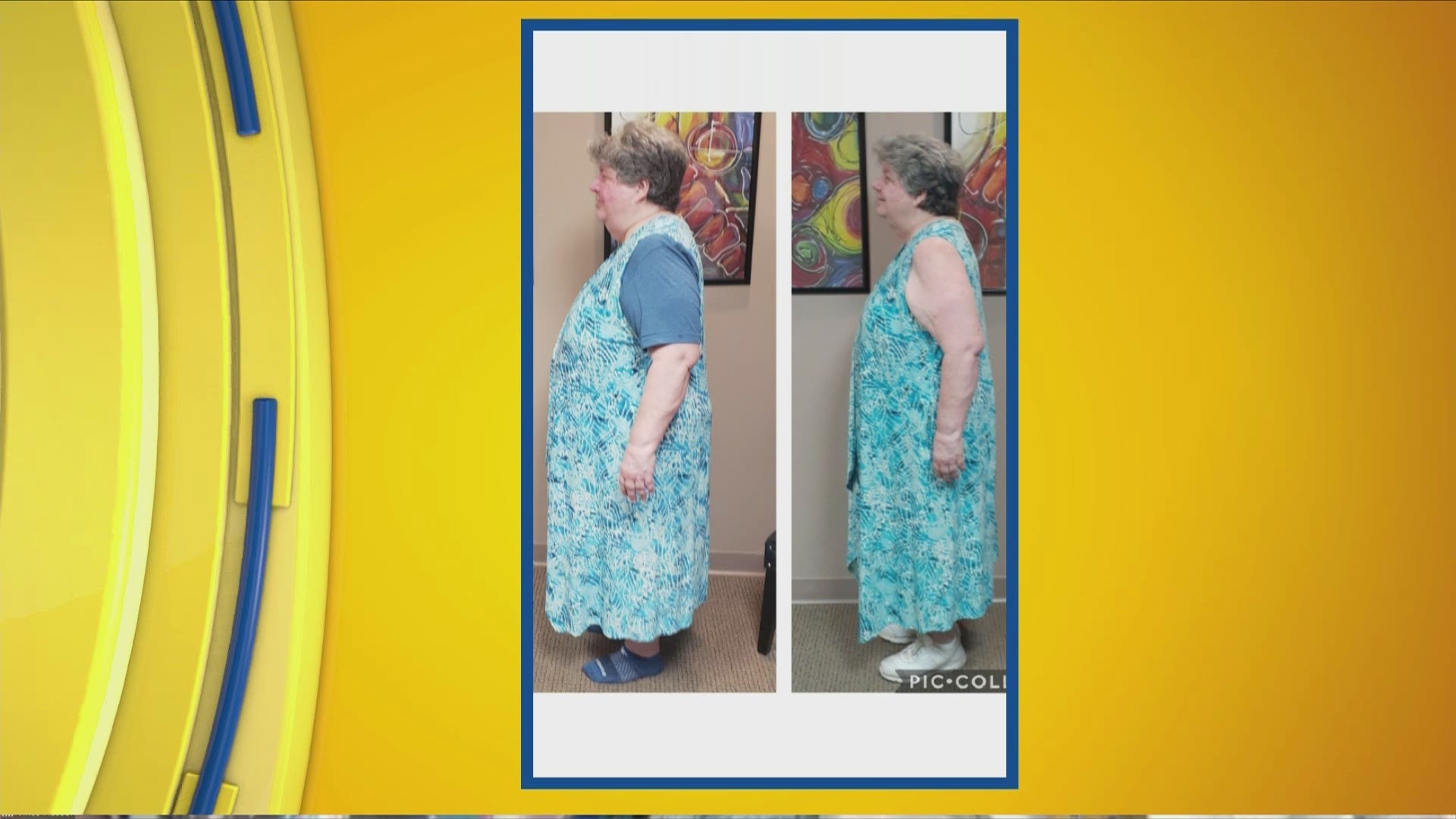 Lou and Jackie meet another weight loss success story on with Dr. Hassel today
