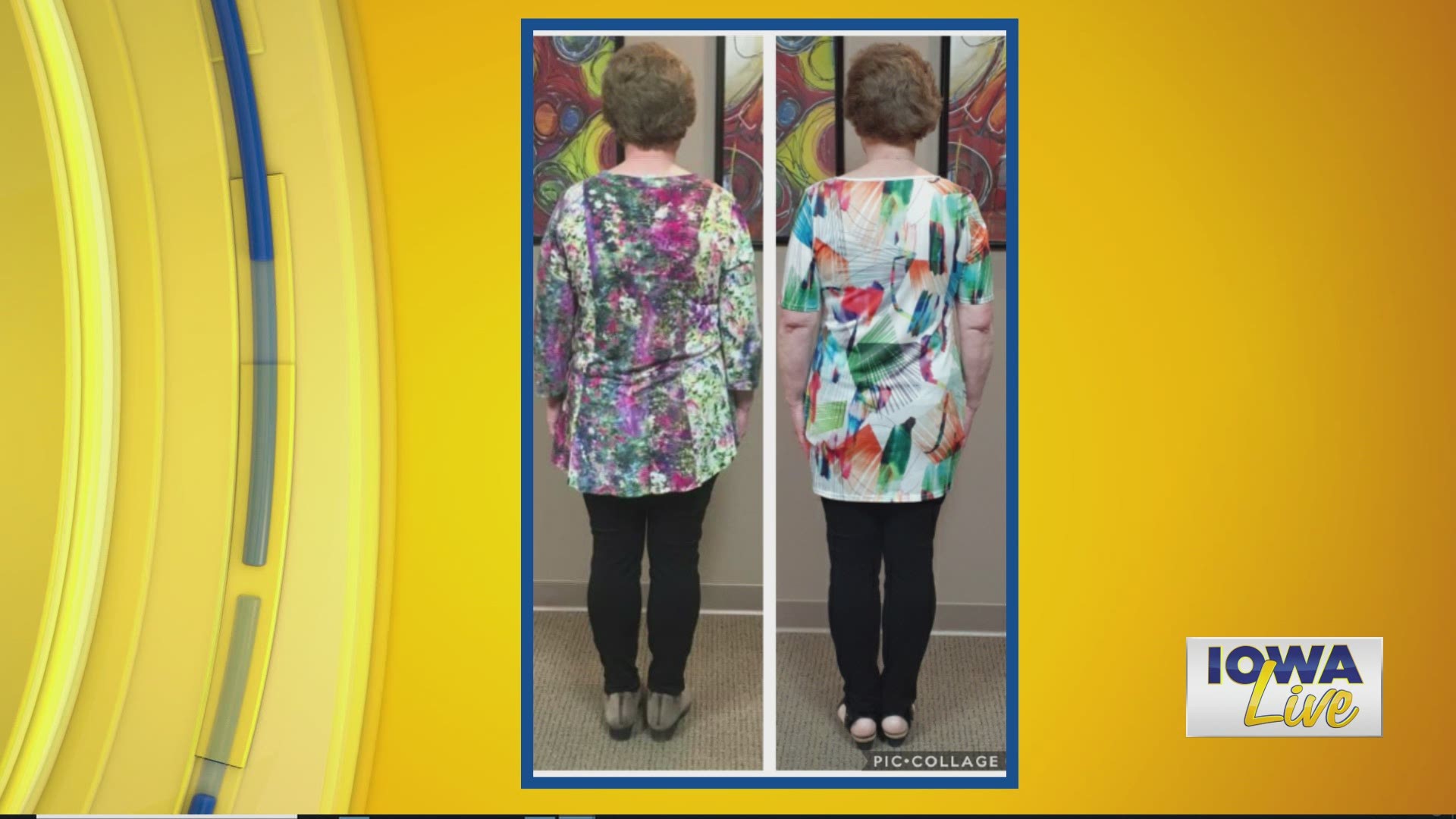 Julie has lost 24 pounds already with Dr. Vince Hassel's weight loss program