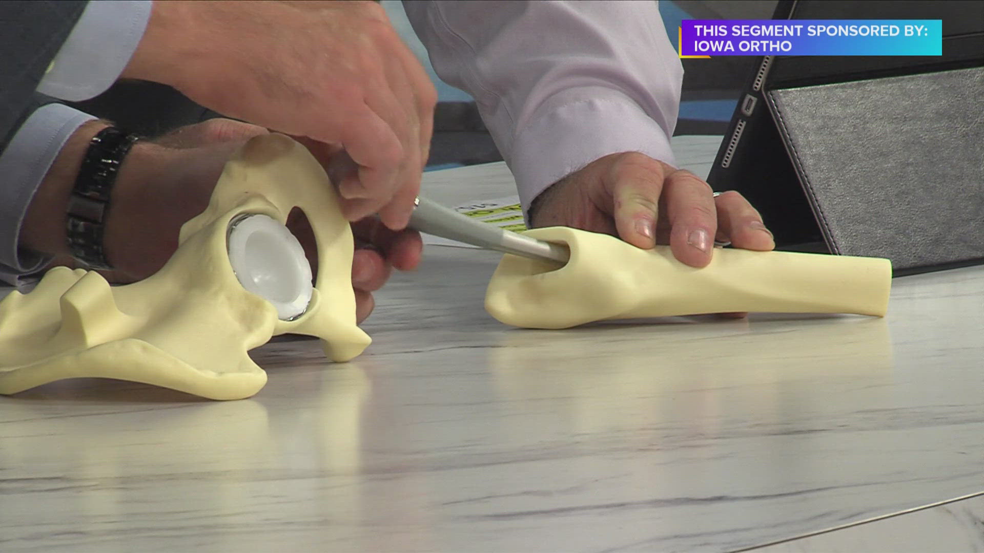 Hip or knee pain? Iowa Ortho explains how you know it's time for