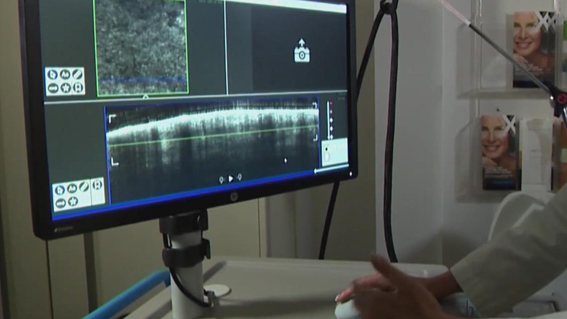 Rising cancer rates in Iowa linked to lifestyle, farming factors, experts say